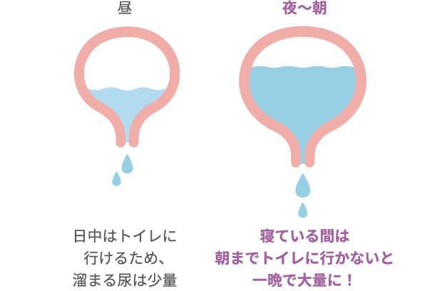 昼 日中はトイレに行けるため、溜まる尿は少量 夜～朝 寝ている間は朝までトイレに行かないと一晩で大量に！